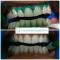 IGIENE DENTALE  SBIANCAMENTO CLICK